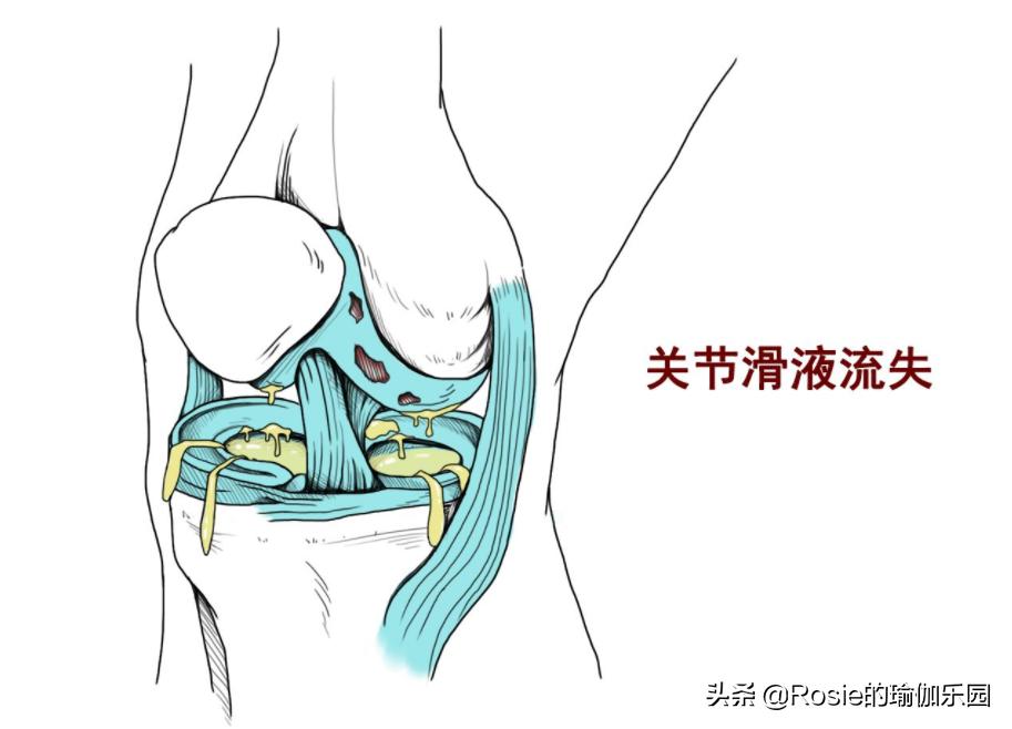 跑步会伤膝盖吗如何保护膝关节,穿高跟鞋经常久站怎么缓解
