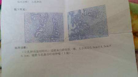 术后多久拆线不拆会有影响吗,手术术后大约几天拆线拆线会痛吗