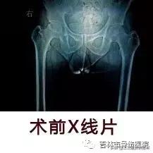 从医30余年，他治疗数以万计骨伤骨病患者