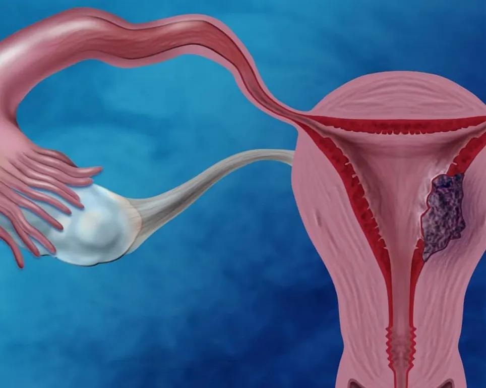 子宫内膜偏厚有什么危害吗,子宫内膜厚很危险吗