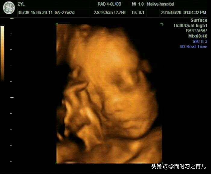 做四维检查胎儿不翻身怎么办,四维彩超常见问题分析