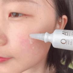 脸上的斑可以通过医美去掉吗,脸上长斑了能用激光去除吗