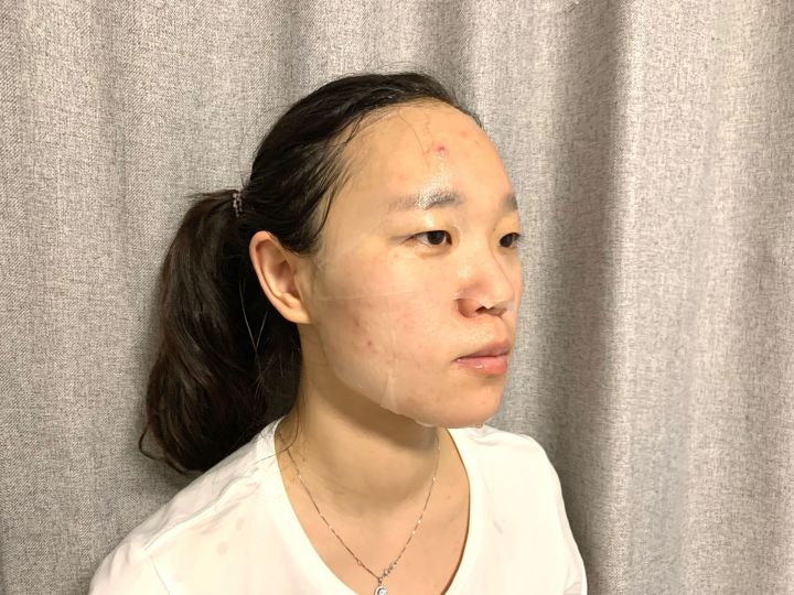 医用冷敷贴补水加修复,医用冷敷贴皮肤屏障修复