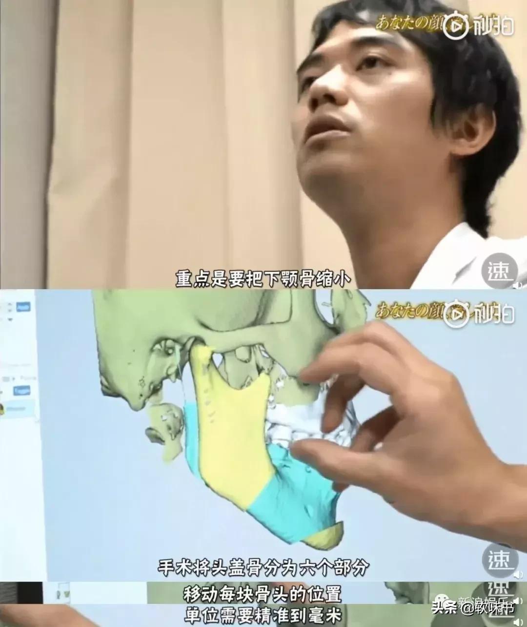 整容脸vs自然脸同龄女星对比,明明是整容脸却没被吐槽过