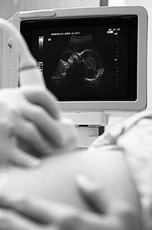 睡梦中羊水破了，关键时刻准妈妈这样做救了自己和孩子