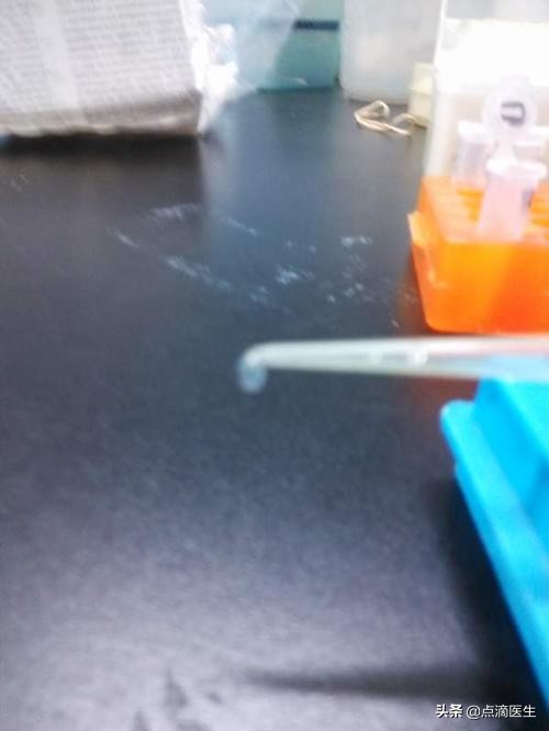 精子全项检查项目,精子全套详细检查