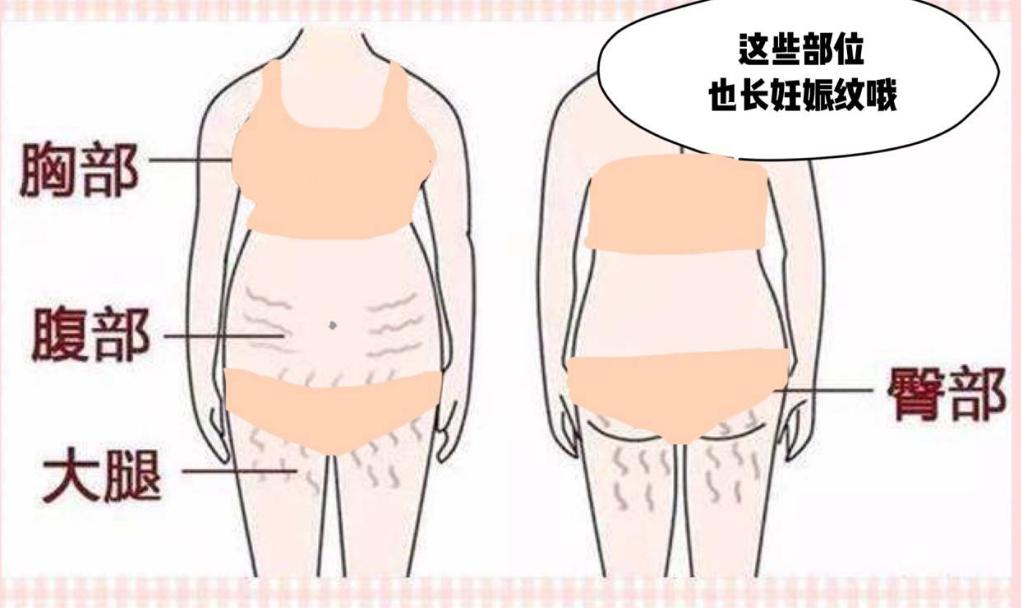 医生坦言：女人生没生过娃，一眼就能看出来，这3点不同很明显！