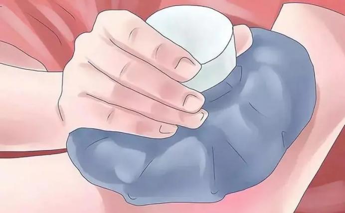 淤青用冷敷还是热敷最有效果,淤青用冷敷还是热敷好