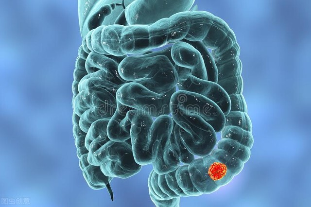 治疗痔疮四个神奇方剂医问医答,痔疮反复发作中药有什么办法治愈