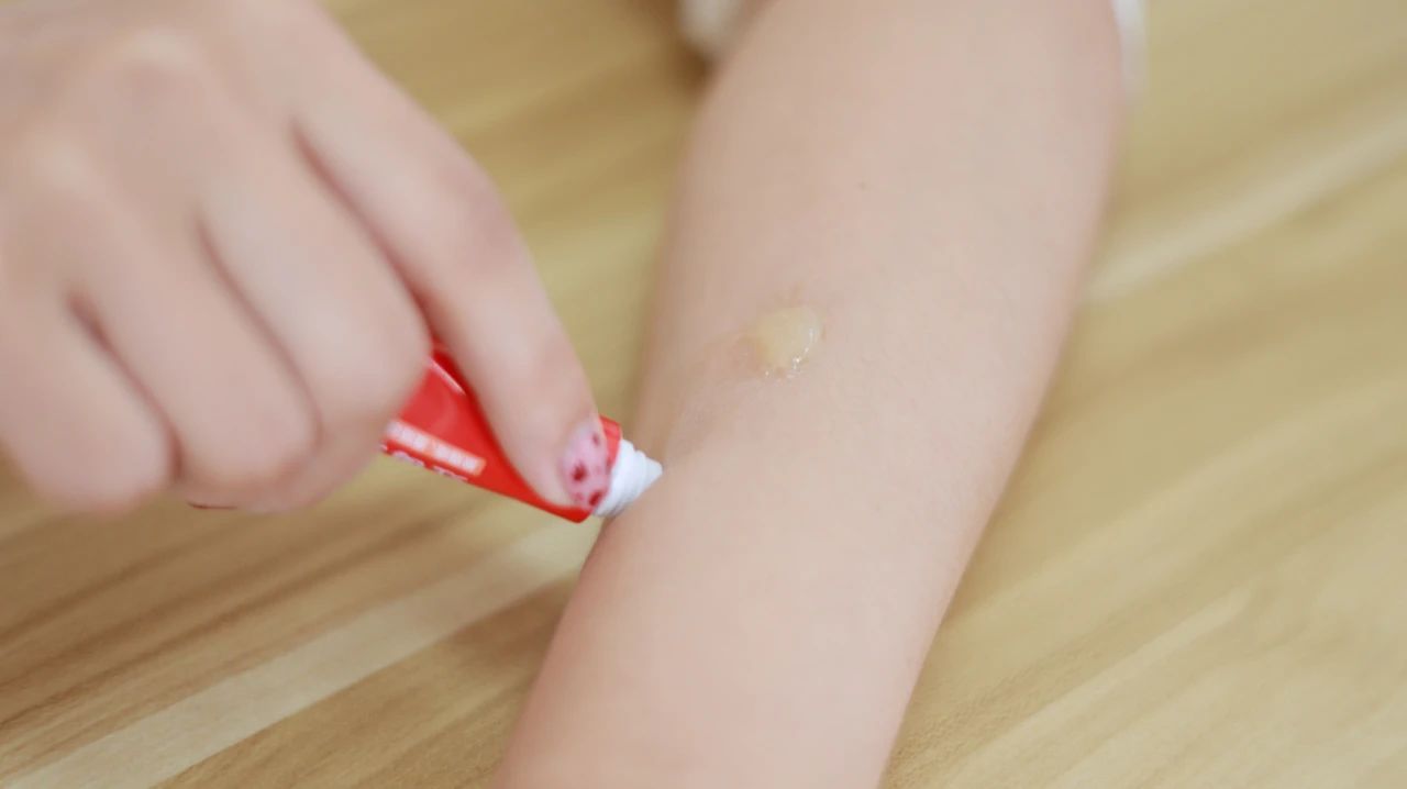 过敏性皮炎注意事项有哪些,过敏性皮炎的症状表现有哪些