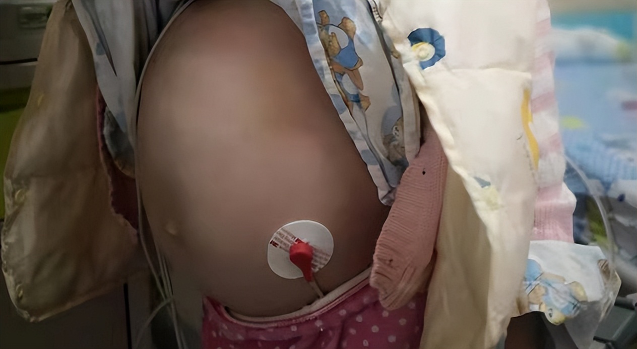 肠道菌群检测有哪些科研方法,肠道菌群检测可以查出哪些疾病