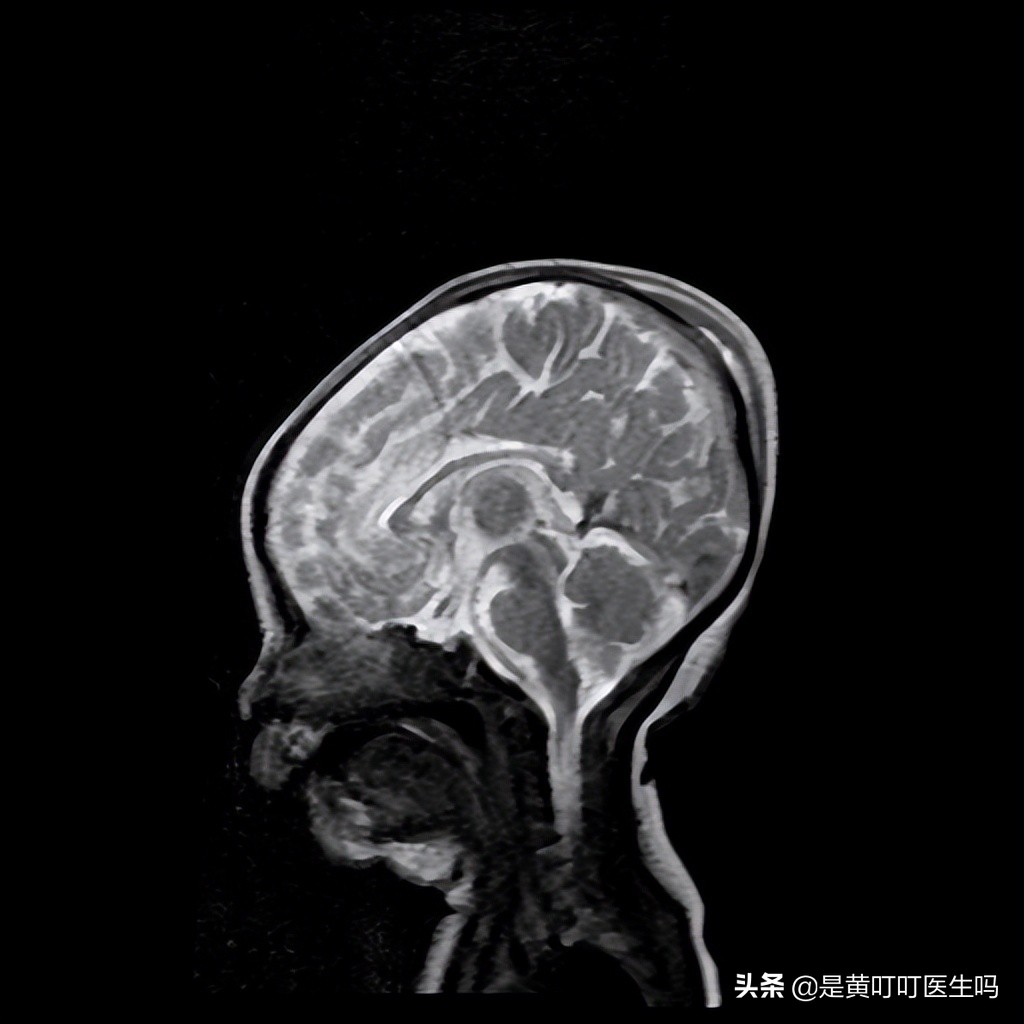婴儿头部畸形一边大一边小,宝宝刚出生时头顶肿了一个大包