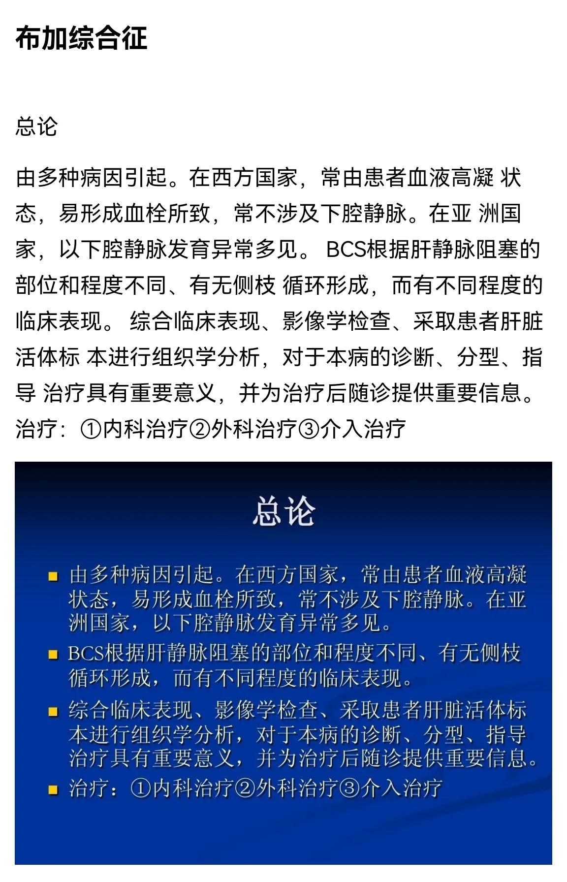 双下肢水肿心源性,心衰双下肢水肿