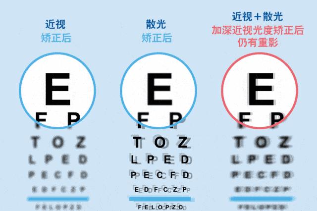 南石眼科医院做近视仪器怎么样,南阳市近视加散光在哪配镜好
