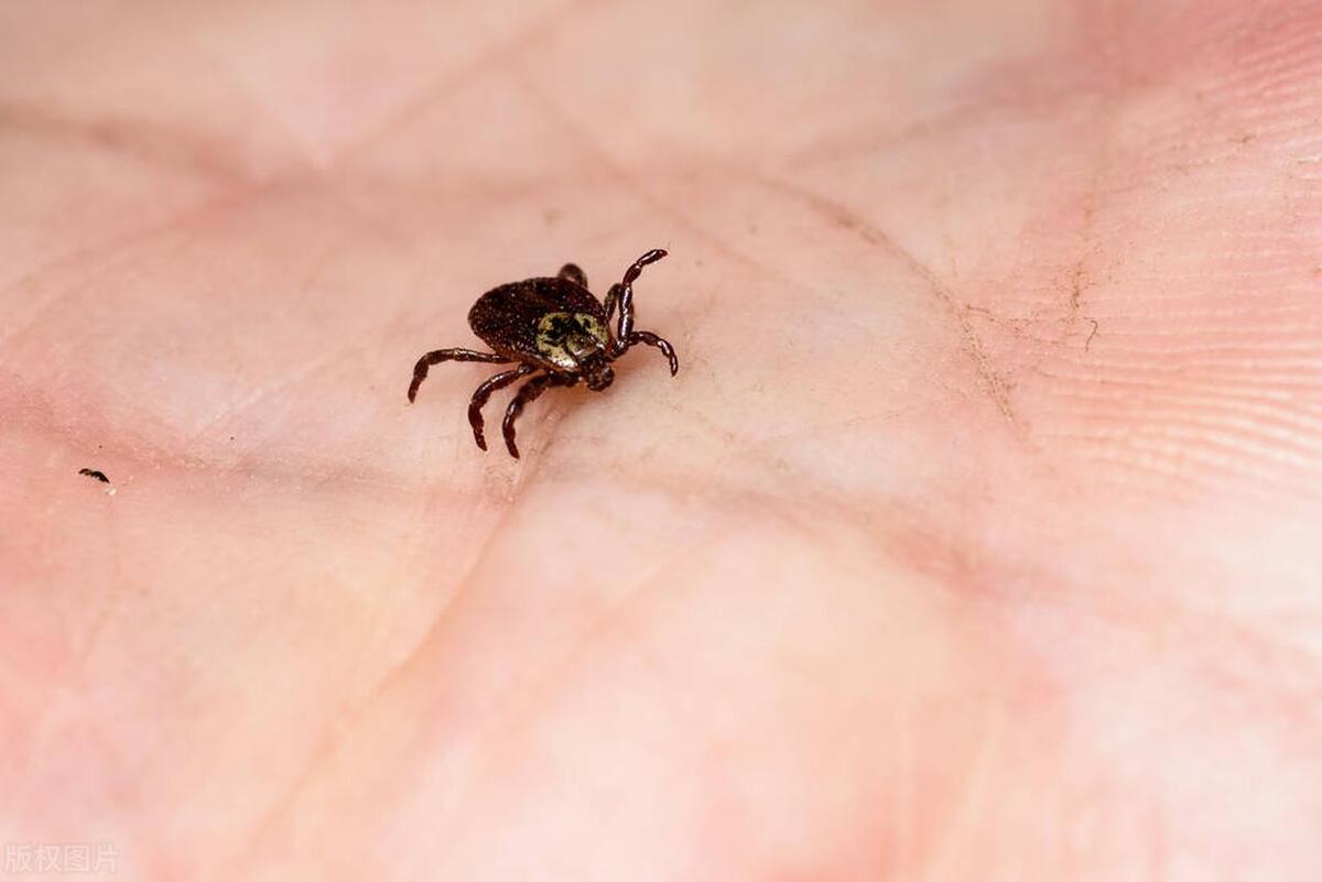 一到夏季胳膊关节内侧起红疹,一到夏天胳膊上起了好多小疙瘩