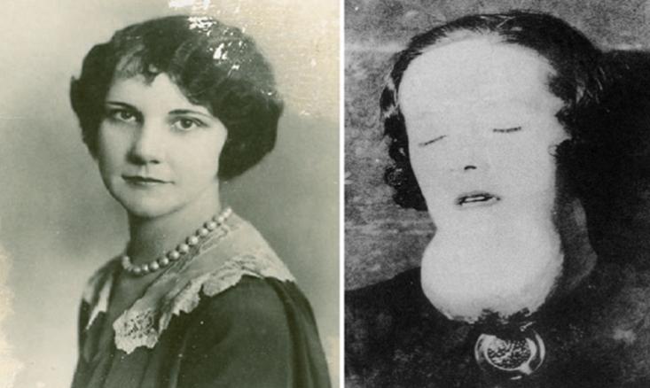 美国男子三年喝下1400瓶核辐射水,1927年喝核辐射水