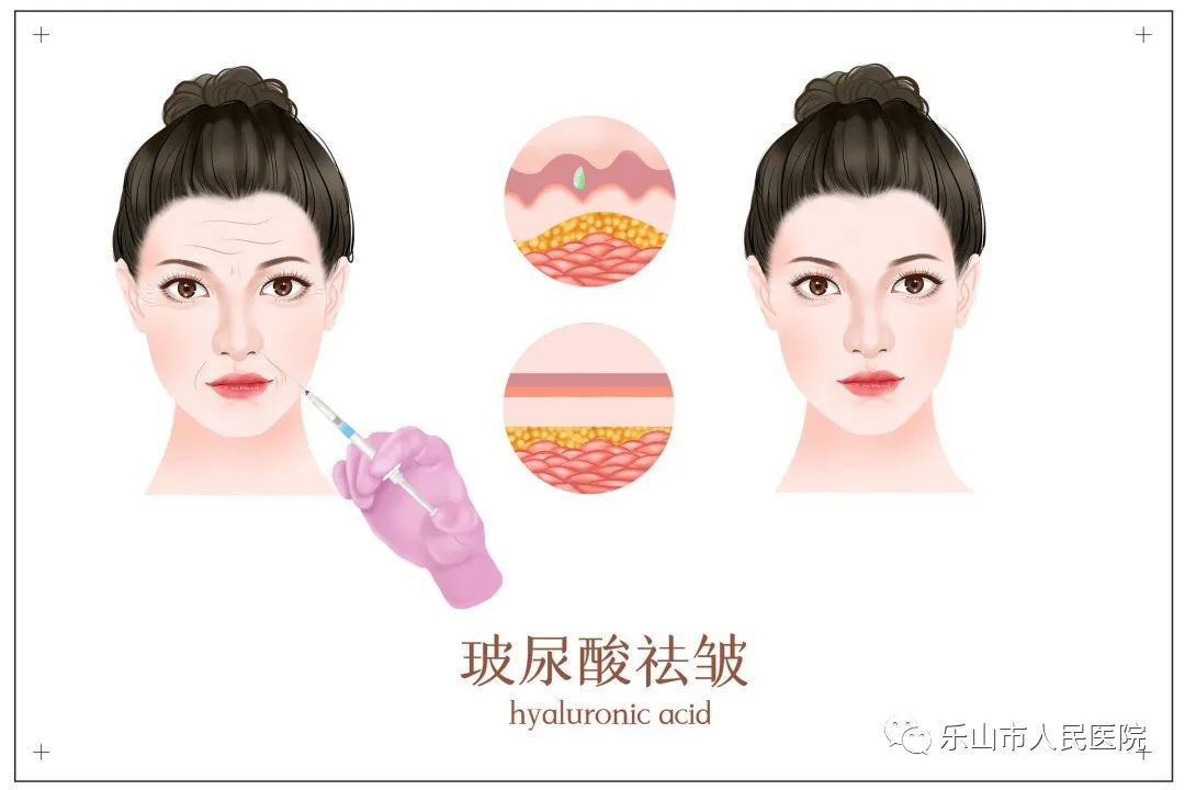 冬天适合做哪些医美项目,秋冬季适合做的医美项目