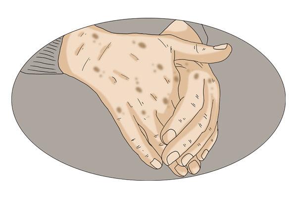 怎样用牙膏洗脸才能去除老年斑,牙膏涂抹治老年斑吗