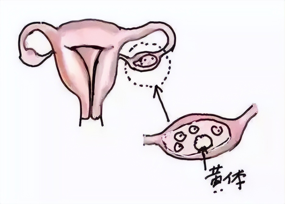 黄体为什么会功能不足,黄体是什么不治疗会怎么样