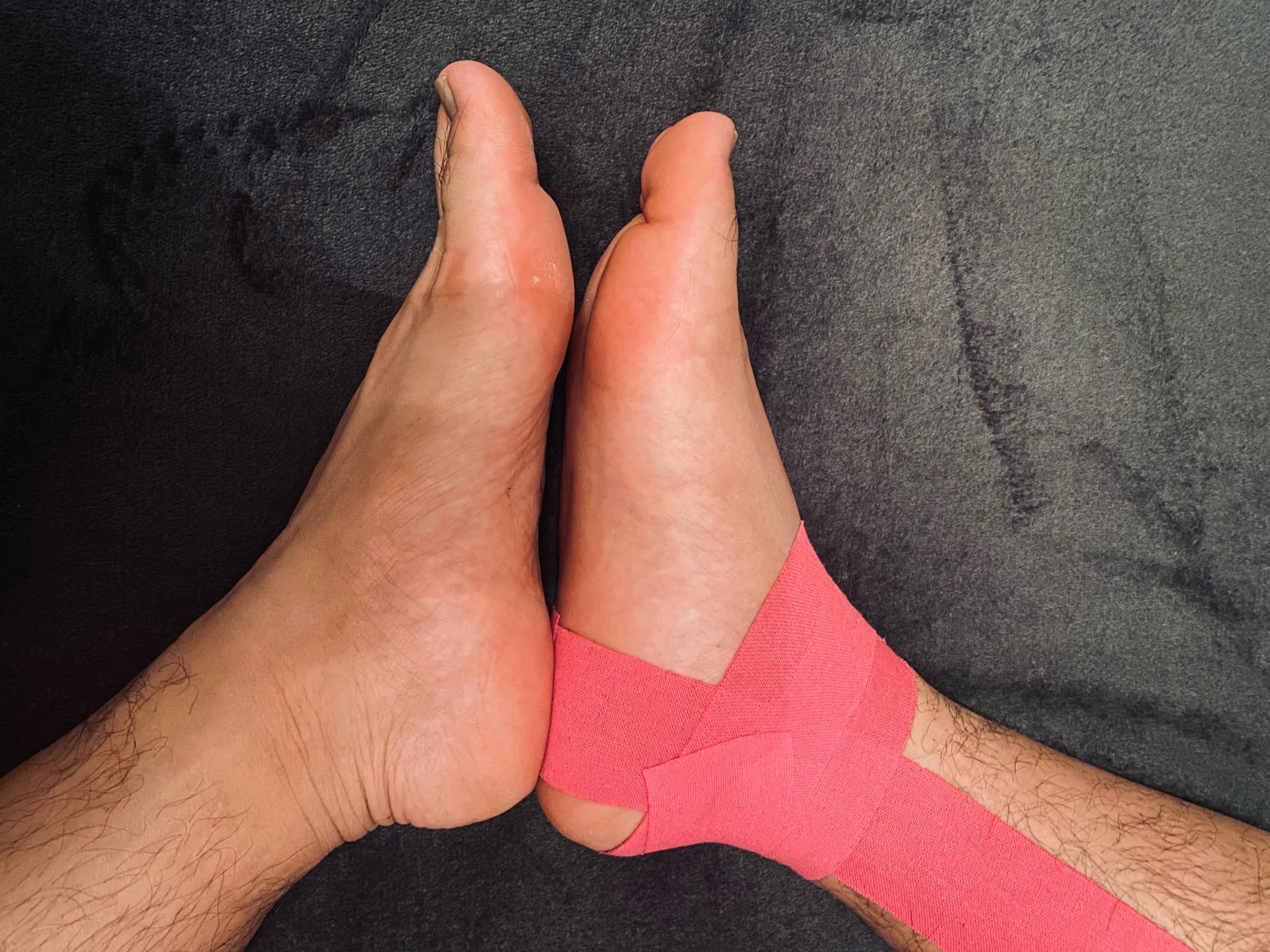 崴脚怎么知道复位了,崴脚别慌4招教你快速康复