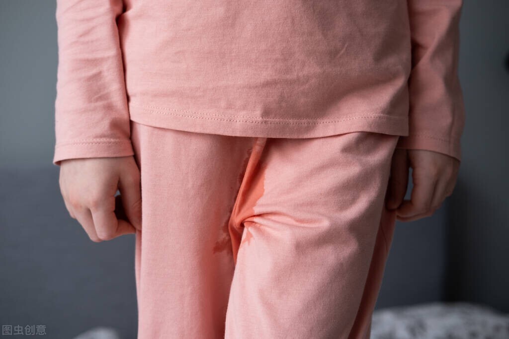 女性尿失禁的五大原因是啥呢,女性如何预防尿不尽