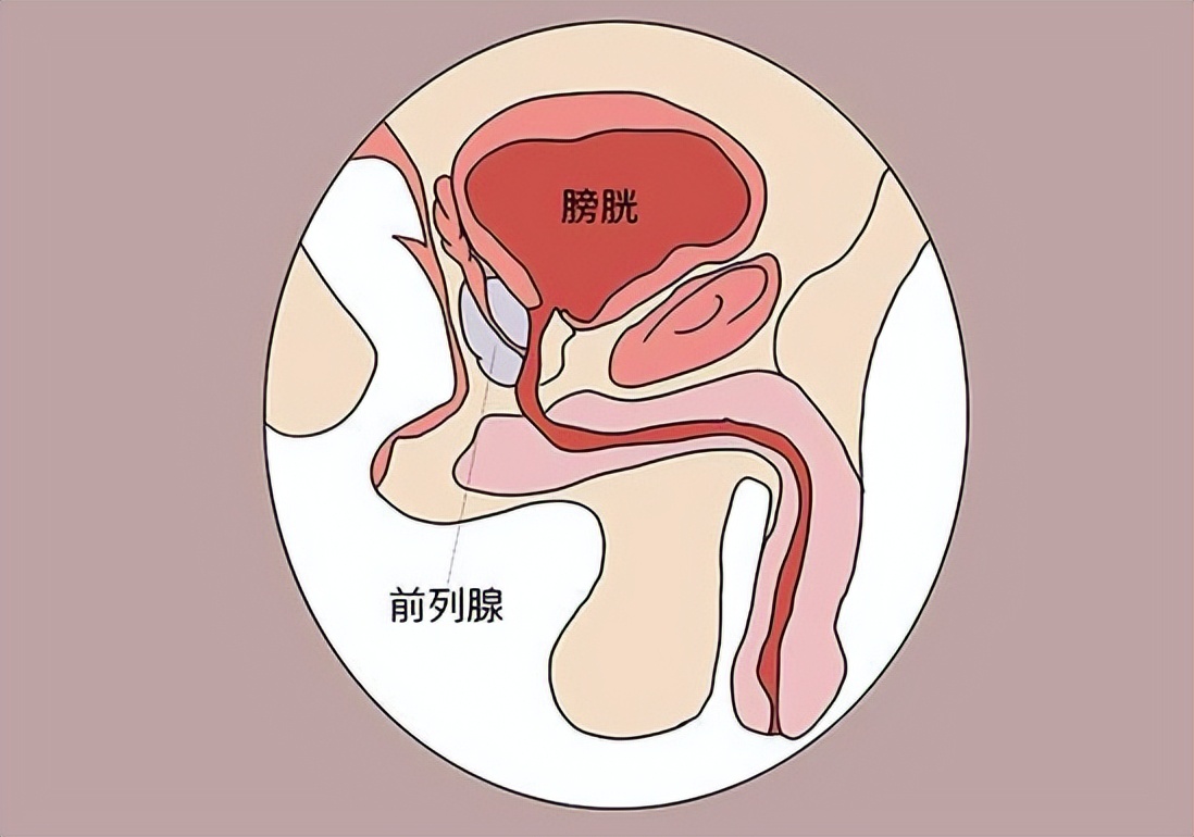 36岁的男性前列腺炎发病率有多高,前列腺炎病因及发病机制