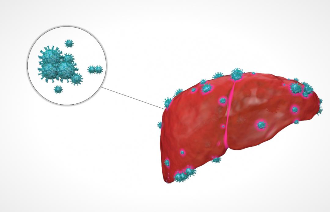 恩替卡韦有哪些缺点,恩替卡韦最佳服法