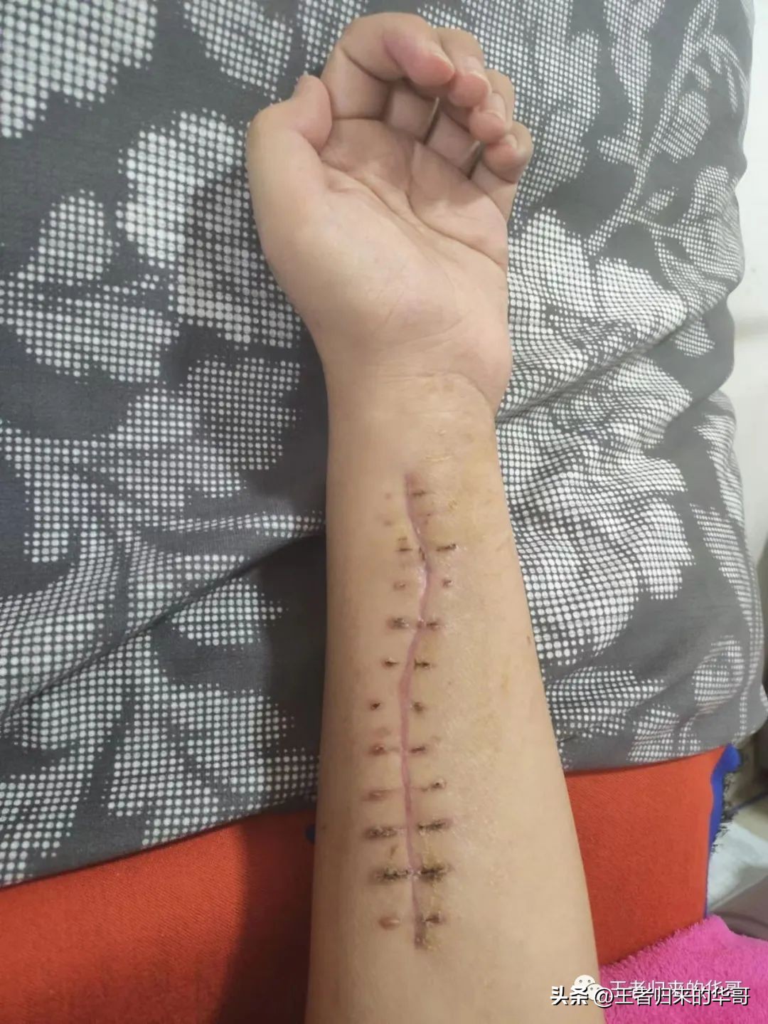 我和疫情下的我做个和解