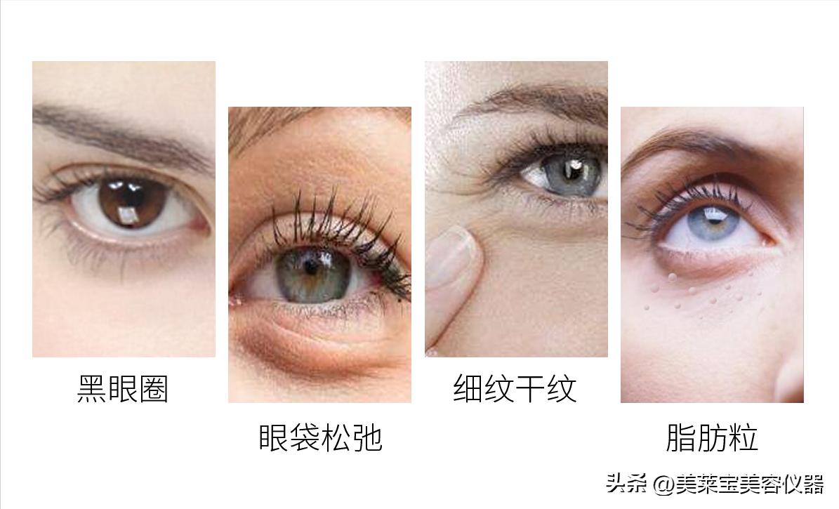 美眼仪对眼睛黑眼圈有效吗,黑眼圈缓解疲劳智能眼部按摩仪器