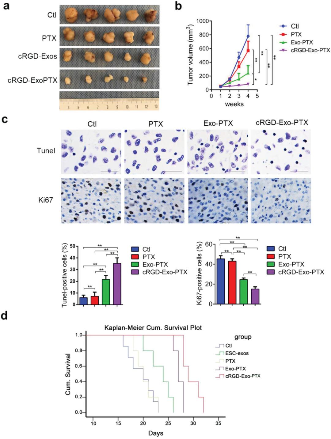 法国最新治疗胶质母细胞瘤,干细胞治疗母细胞胶质瘤