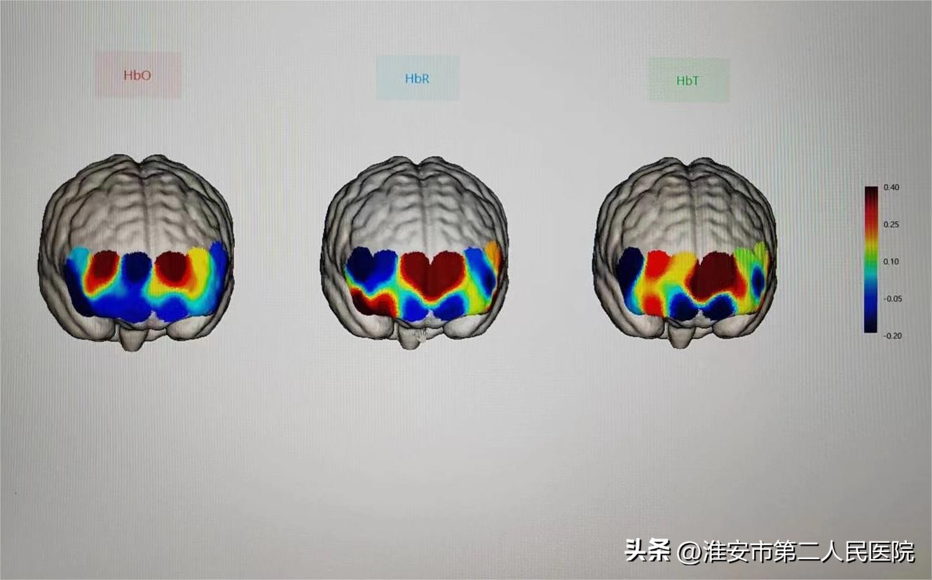 一双“慧眼”看透万千烦“脑”！淮安二院开展近红外光谱成像技术