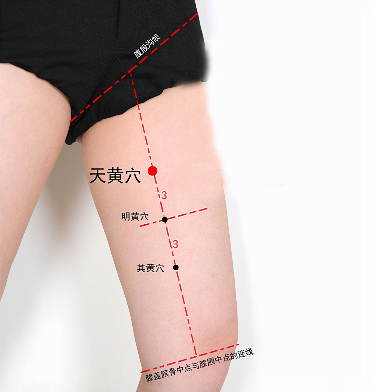 中医经络调理针灸视频,中医针灸规范处方范例