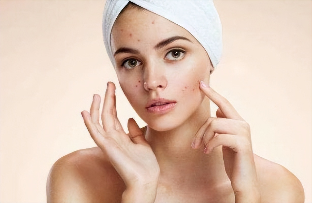 红霉素软膏真的能祛除老年斑吗,红霉素软膏去老年斑小妙招