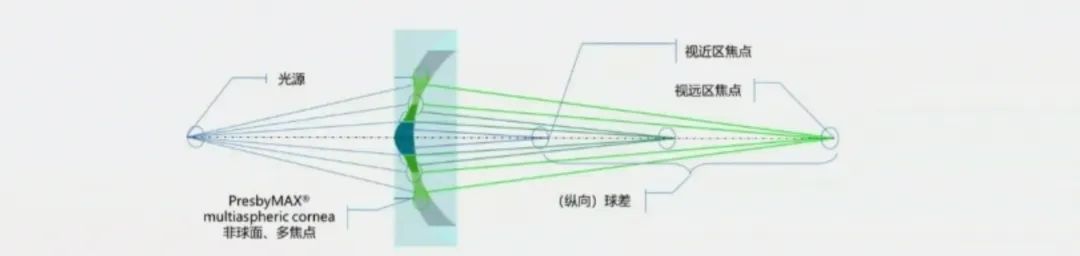 西丽医院眼科老花眼可以做手术吗,南阳南石医院近视眼手术价格表