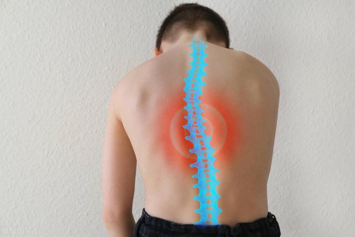 正骨推拿对脊柱侧弯有疗效吗,脊柱侧弯正骨后有什么后遗症