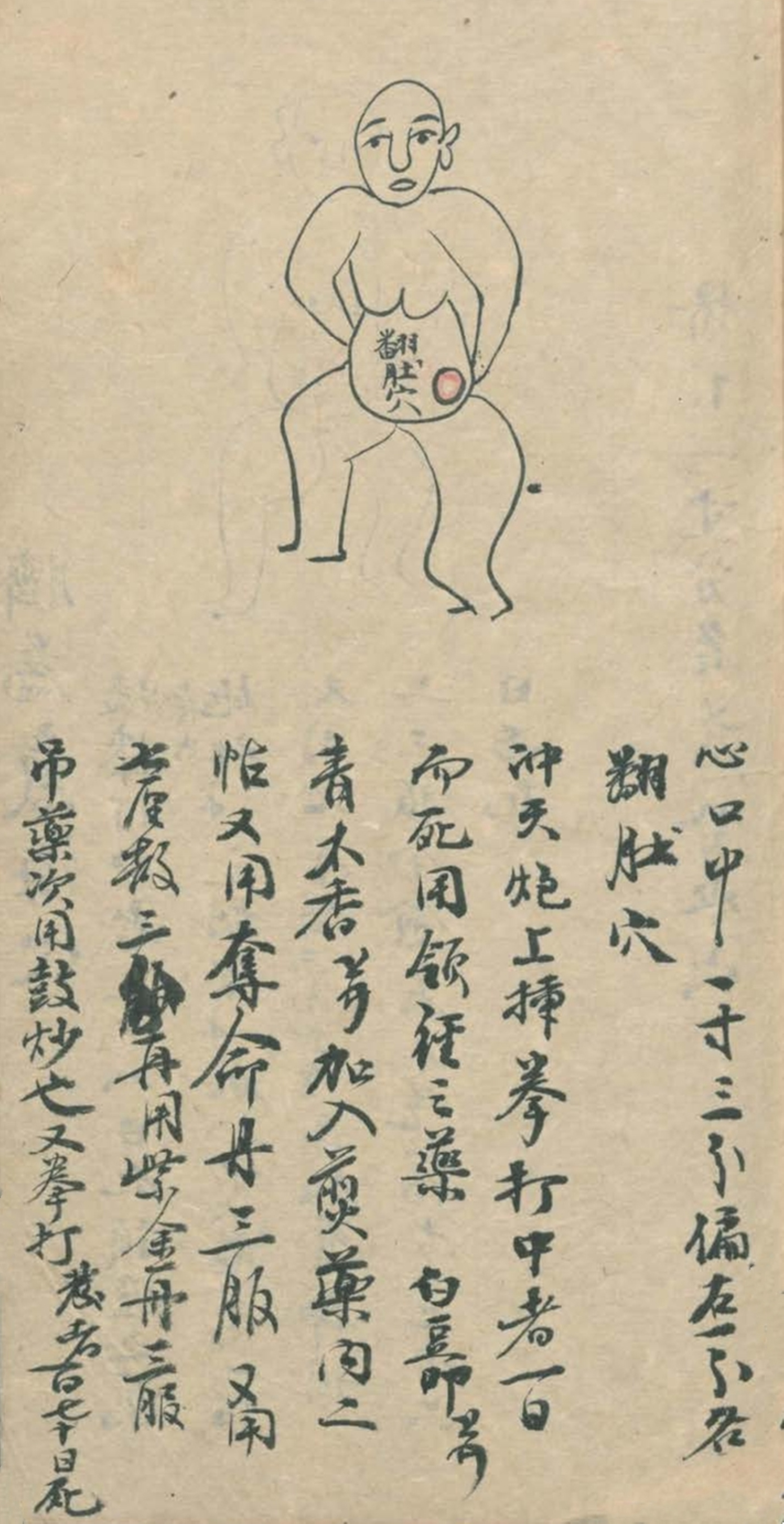 武当秘传跌打八法,民间中医古籍手抄本专医跌打秘方