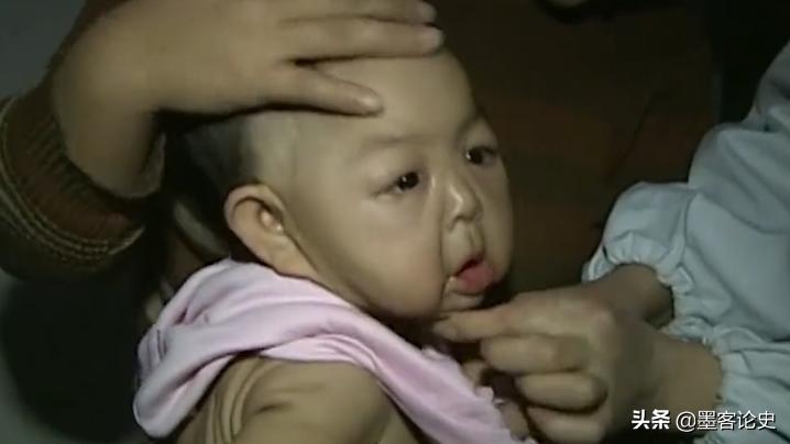 故事:河南1岁女婴患早老症,一夜变成80岁老人,母亲含泪千里求医