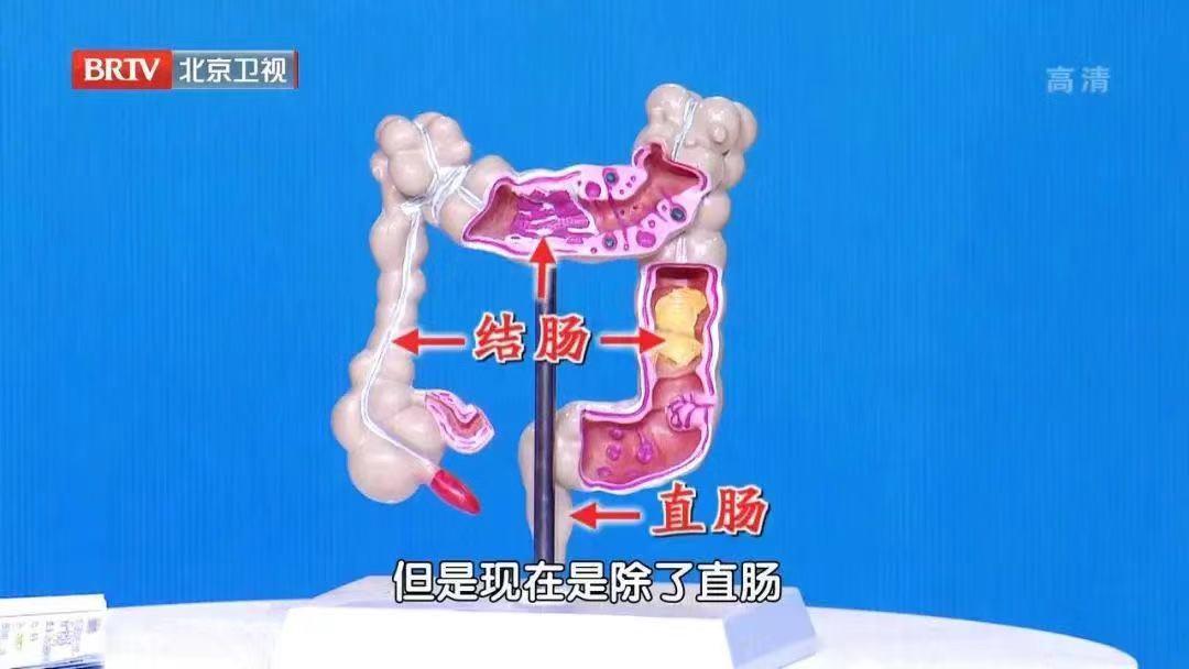 屁股洗不对，痒、痛、痔疮…都可能找上门！今天教你正确护理法