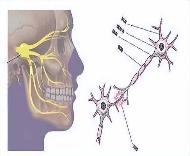 兰州市慢性疼痛实用诊疗技术,兰州二院疼痛科专门治什么病