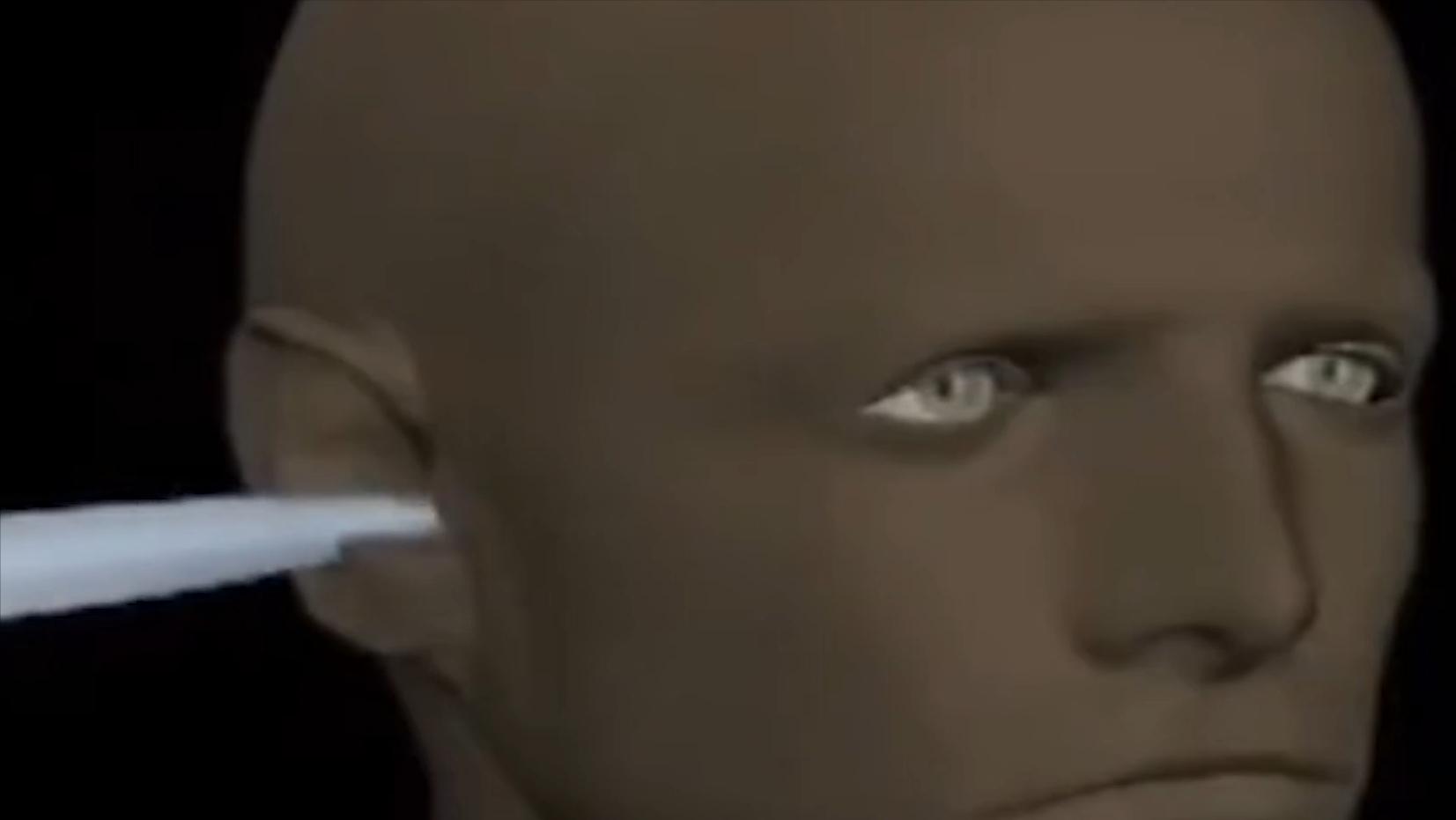 云南男子口臭手术后现在怎么样了,云南男子口臭查出了大毛病