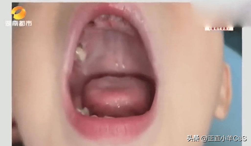 广西37岁孕妇,37岁广西孕妇