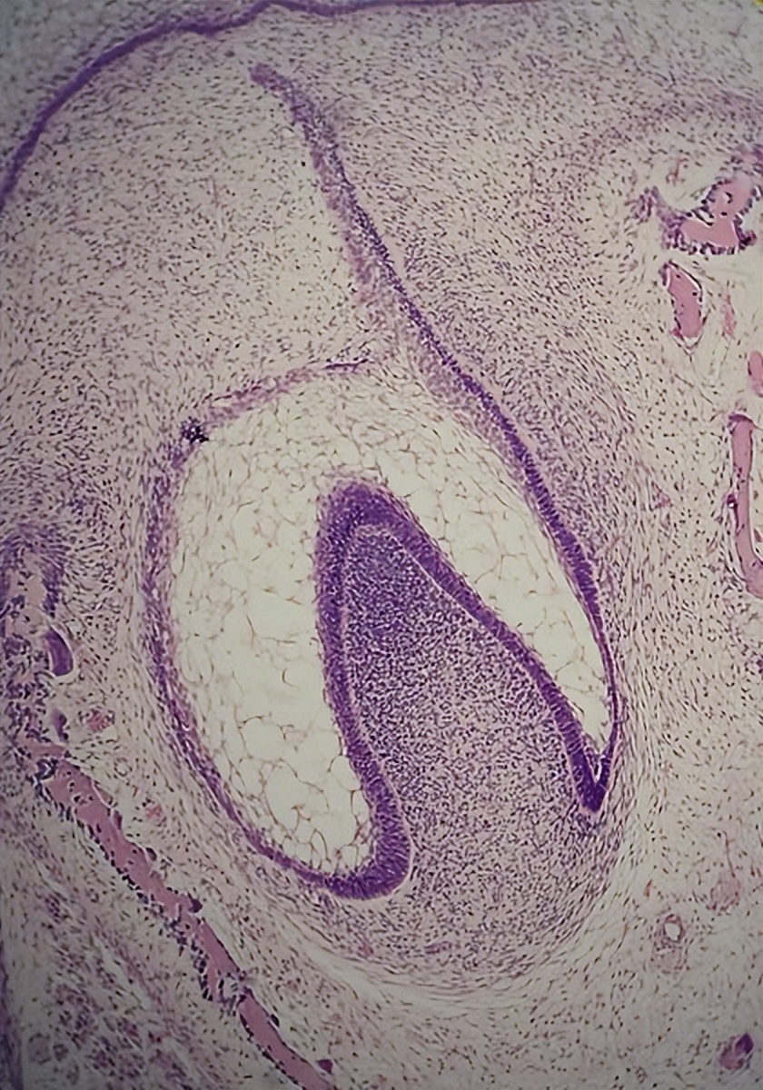 牙齿是怎样长出来的全过程,牙齿是怎样长出来的视频英文版