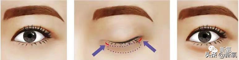 福原爱离婚后孩子跟谁,深度解析福原爱婚变