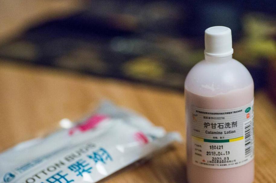 炉甘石洗剂的作用和功效价格,炉甘石洗剂的功效与作用和价格