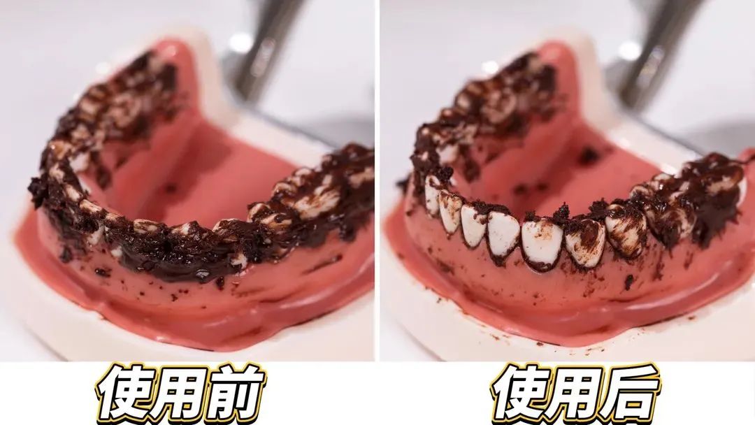 电动冲牙器便携式深层清洁牙齿,牙刷电动软毛护牙