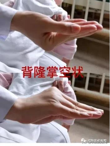 一个月婴儿排痰的正确方法,宝宝有痰排不出立马这样做管用