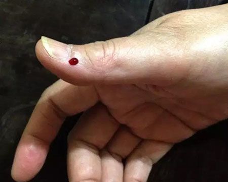 阳了嗓子像刀割一样怎么办,阳了嗓子如刀割吃什么药