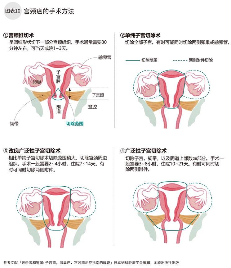 宫颈癌确诊检测哪几项,宫颈癌确诊的活检报告