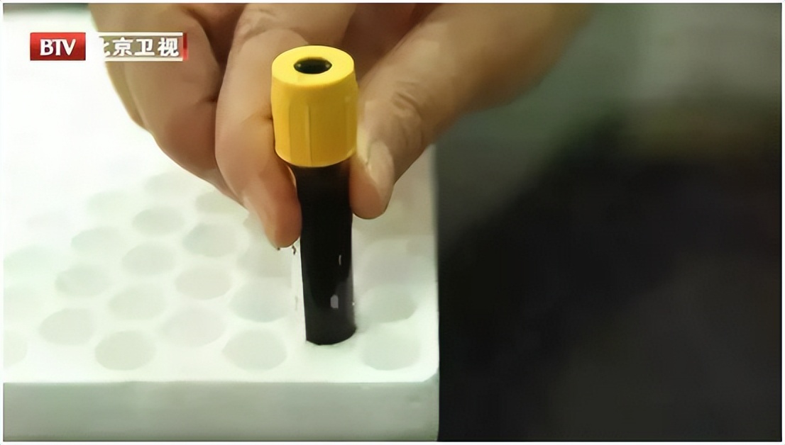 最近身体各个地方相继发炎,吃的东西会导致身体急性炎症