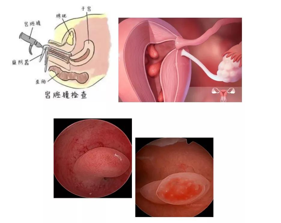 微创妇科手术是什么样的手术,妇科微创手术和传统手术的区别